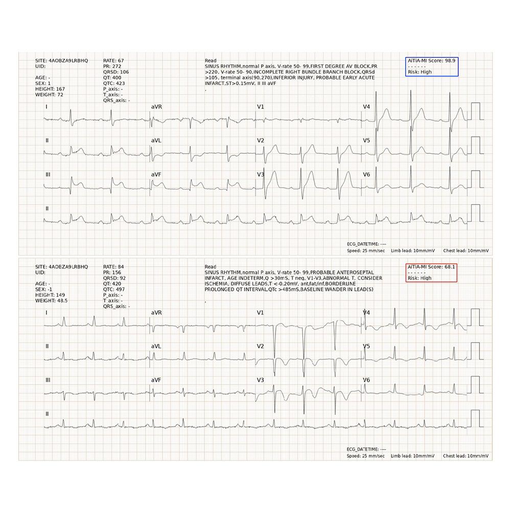 AiTiA AiTiAMI Medical AI